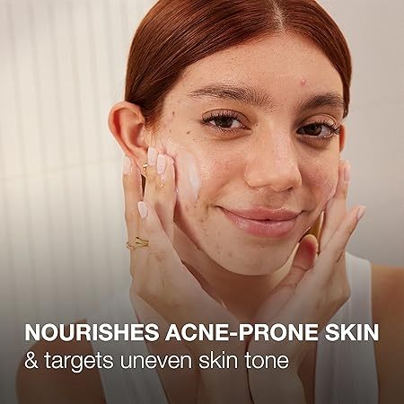 🇺🇸 Neutrogena 141g Ultra Gentle Face Gel Pro-Vitamin B5 & Niacinamide Acne-Prone Skin & Uneven Tone