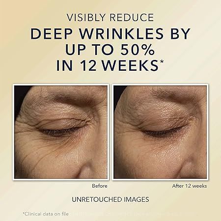 🇫🇷 RoC 30ml Retinol Correxion Deep Wrinkle Anti-Aging Day SPF30 Night Moisturizer & Filler